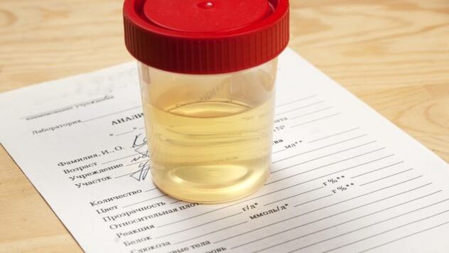 arterial hypertension urine analysis